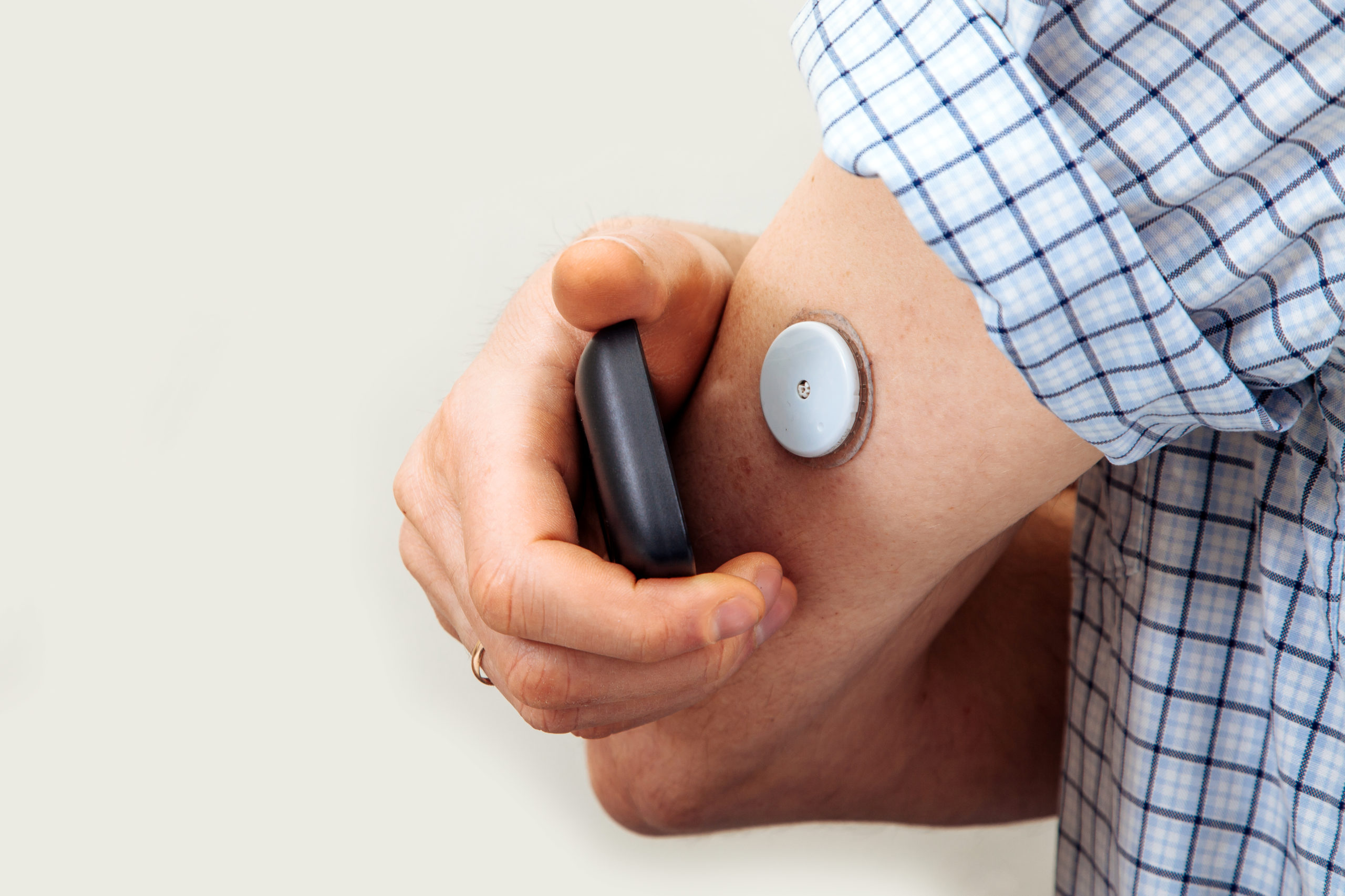 SROI voor inzet Flash Glucose Monitoring bij mensen met diabetes